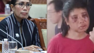 “Jika Saya Tak Pinjam HP, Mungkin Saya Sudah Mati” Kisah Intan, Derita PRT dari Sumba yang Disiksa Majikan di Batam